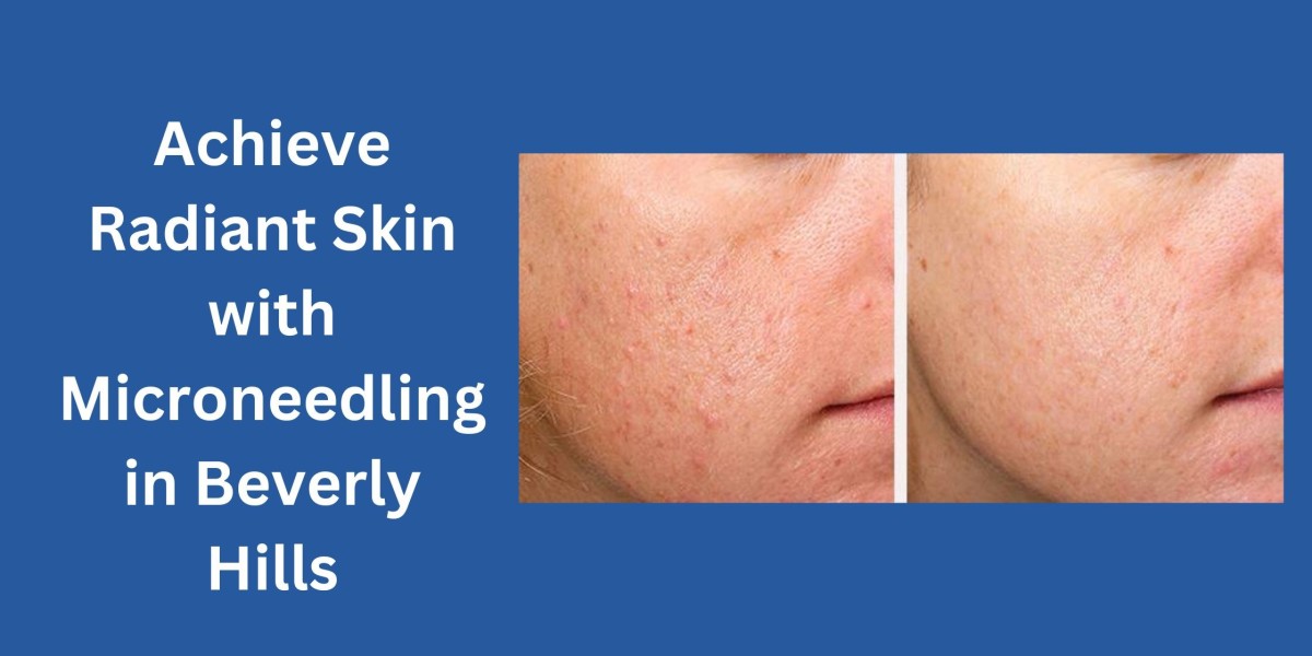 Achieve Radiant Skin with Microneedling in Beverly Hills